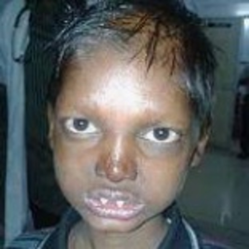 Meet your Posher, Abdikar